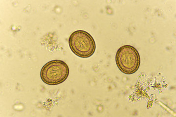 Egg of Taenia in stool, analyze by microscope


