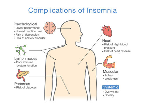 Diagram of Complications of Insomnia. llustration about effects of health problem. 