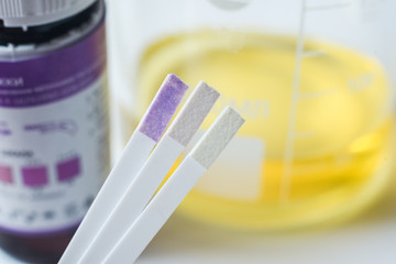 urine test for acetone