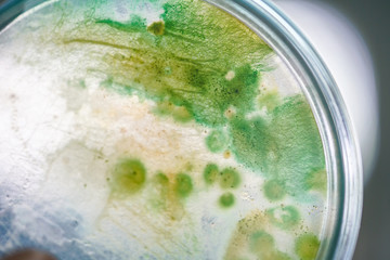 Colony of blue green algae in culture medium plate.