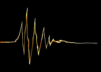 Elektrokardiogramm EKG