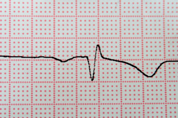 Close up of electrocardiogram in paper form.
