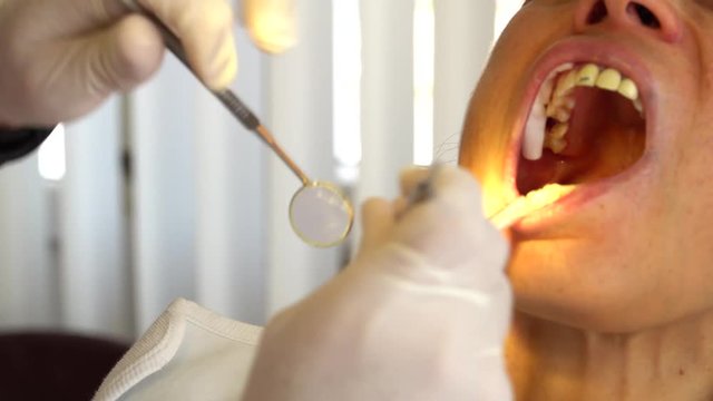 Dentist treating teeth to woman patient in clinic. Female professional doctor stomatologist at work. Dental equipment on background. Dental check up