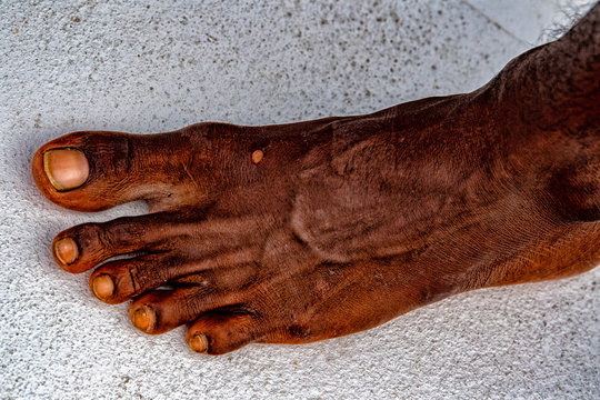 Black Man Migrant Feet Detail No Shoes