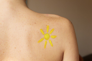 freckles on the back