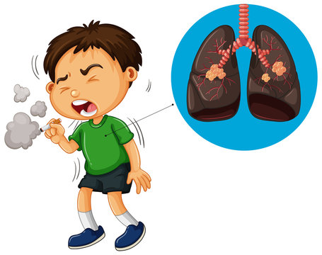 Boy smoking cigarette and unhealthy lungs diagram