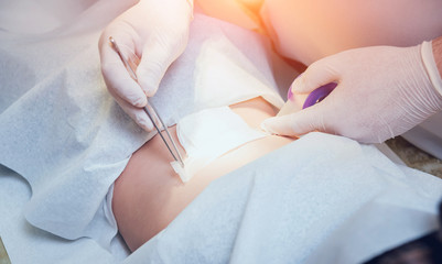 Surgeon and patient in operating room with surgery equipment.