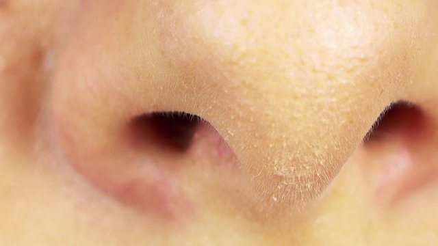 A woman squeezes her nose - closeup