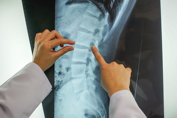 closeup of professional doctor is explaining the radiology results to the patient to increase understanding of the cause of the injury. medical and healthcare concept. - obrazy, fototapety, plakaty