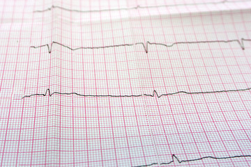 Close up of an electrocardiogram in paper form.