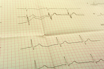 EGGor ECG paper the ECG Is the result of Stress test and pink heart shape out of pills. The promotion package to check your heart up high or older the concept of people.