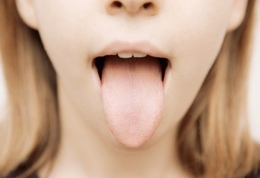 Lingua fuori, bocca aperta, visita medica alla lingua o gola