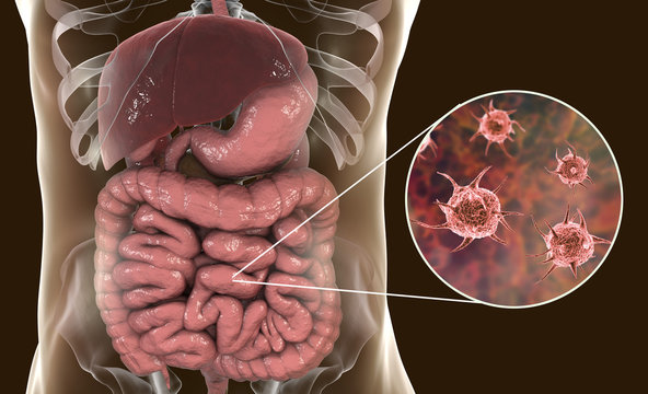 Parasitic infection of intestine, 3D illustration showing close-up view of an abstract parasite and anatomy of human digestive system