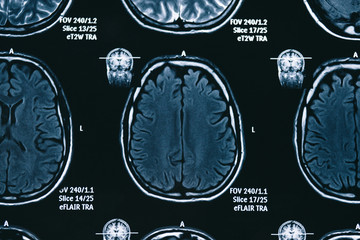 X-ray, MRI brain scan