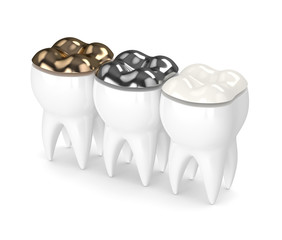 3d render of teeth with different types of dental filling