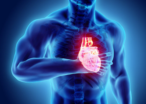 3d illustration of human heart attack.