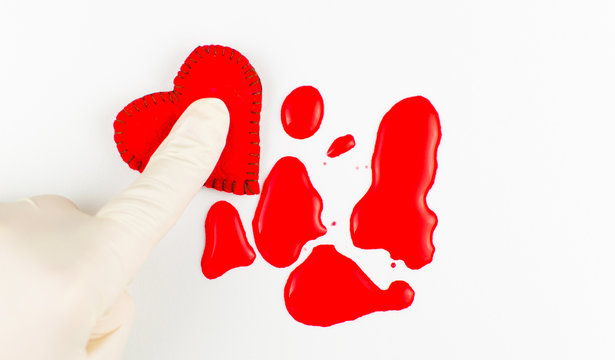 The concept of a broken heart. A hand in a rubber glove compresses the heart and blood stains around.