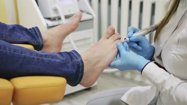 hands of the physician of the podologist in blue gloves make a hardware pedicure of male legs in the medical office, close-up