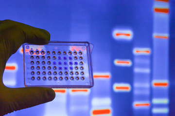 Laboratory DNA testing.