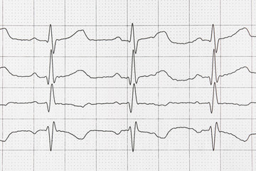 Paper cardiogram for heart, medical concept