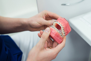 braces model  © shapovalphoto