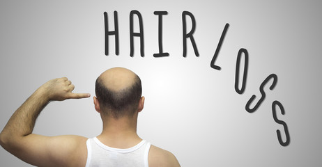 Hair loss - adult man hand pointing his bald head