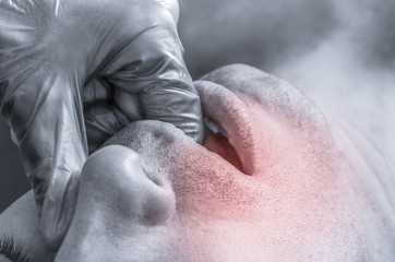 Naklejka premium Physiotherapist is doing intraoral technique of massage masseter muscle. Osteopathy