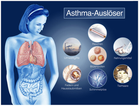 Asthma-Ausl&ouml;ser.Allergien.Immunsystem.