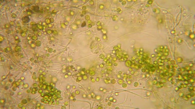 Microscopic view of organisms in the fusty water with rotten vegetation. Euglena Viridis