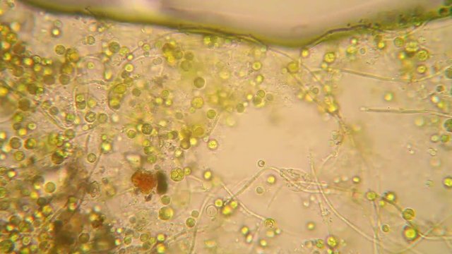 Microscopic view of organisms in the fusty water with rotten vegetation. Euglena Viridis
