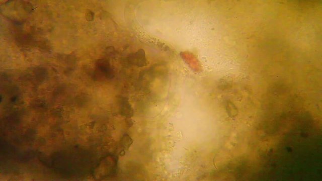 Microscopic view of organisms in the fusty water 