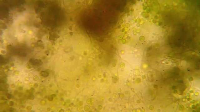 Microscopic view of organisms in the fusty water. Rotifers