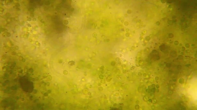 Microscopic view of organisms in the fusty water with rotten vegetation
