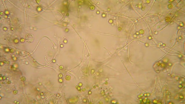Microscopic view of organisms in the fusty water with rotten vegetation. Euglena Viridis