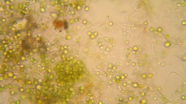 Microscopic view of organisms in the fusty water with rotten vegetation. Euglena Viridis