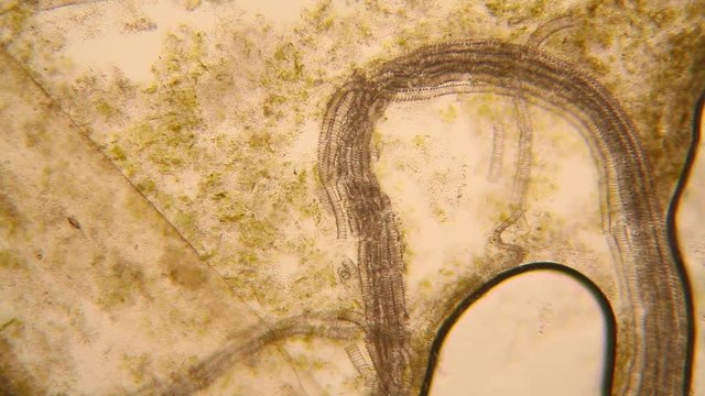 Microscopic view of organisms in the fusty water with rotten vegetation. Paramecium caudatum
