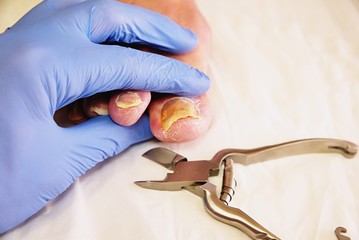 Close-up of a manicurist with pedicure pliers trimming old person toenail.