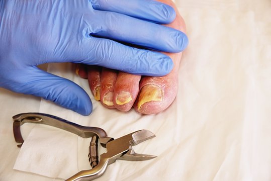 Pedicurist hands in  sterile gloves cut nails and cuticles closeup . Hardware manicure.