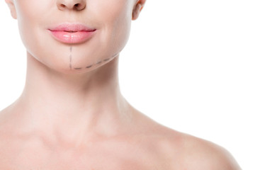 Cropped view of woman with painted lines on face for plastic surgery isolated on white