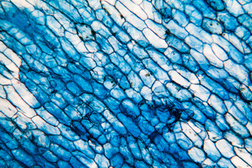Onion cells at the microscope
