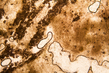 Mold at the microscope
