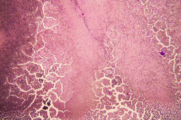 Yeast at the microscope
