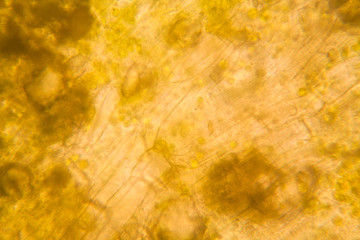 Rotten leaves at the microscope
