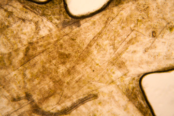 Microscopic view and details of rotten tulip stem
