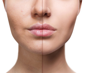 Perfect woman's lips before and after retouch.