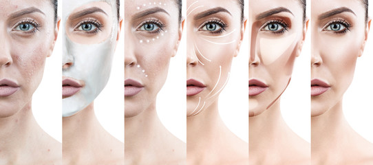Woman step by step improves her skin condition.
