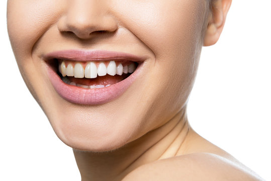 Teeth befor and after care, therapy and whitening. Laughing woman mouth with great teeth over white background. Healthy beautiful female smile.