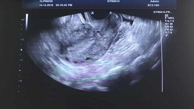 Simulated Heart Monitor Screen