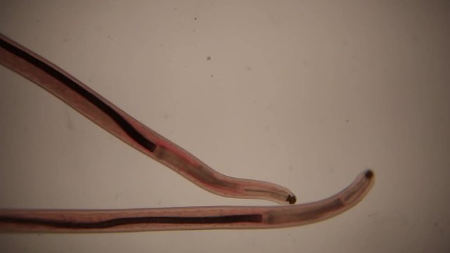  Camallanus is a genus of parasitic roundworms in the family Camallanidae  for education in laboratory.
