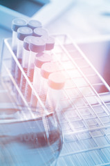 Vacutainer or test tube in lab on table